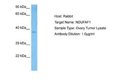 NDUFAF1 Rabbit anti-Human, Polyclonal, Novus Biologicals 0.1ml; Unconjugated:Antibodies,